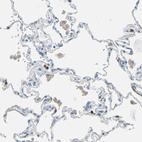 Immunohistochemical staining of human lung shows weak to moderate positivity in macrophages.