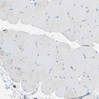 Immunohistochemical staining of human skeletal muscle shows no positivity in myocytes as expected.