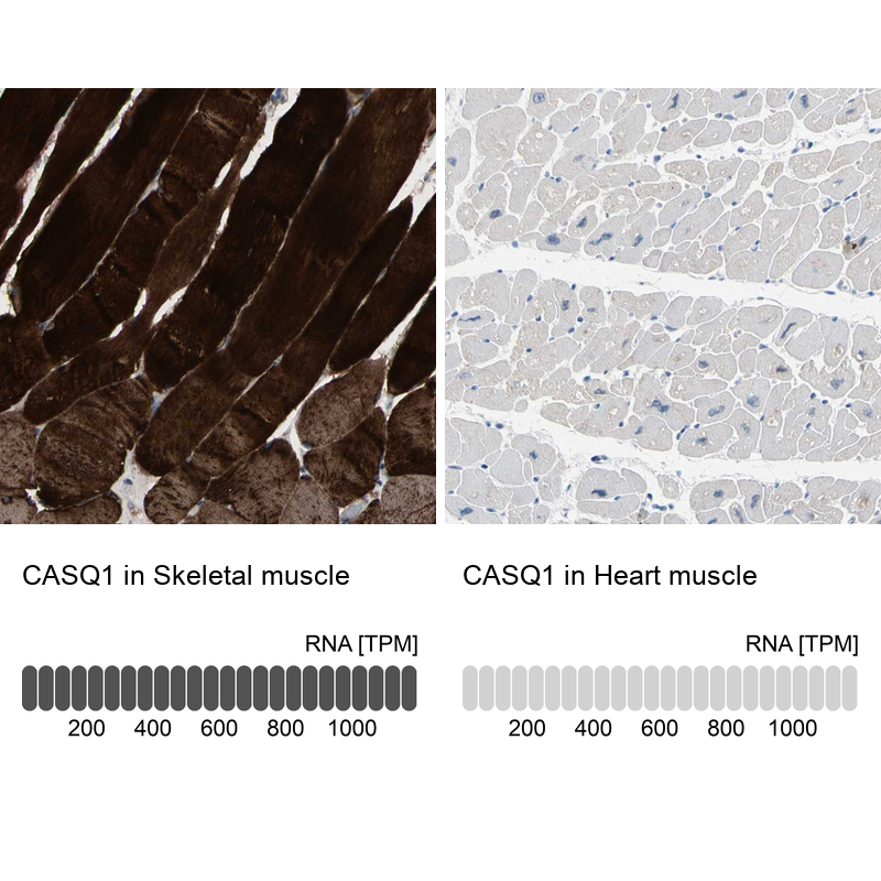 Anti-CASQ1 Antibody