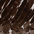 Immunohistochemical staining of human skeletal muscle shows high expression.
