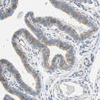Anti-TNFRSF12A Antibody