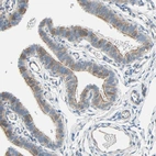 Immunohistochemical staining of human fallopian tube shows moderate to strong membranous positivity in glandular cells.