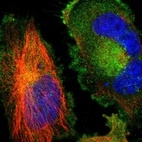 Immunofluorescent staining of human cell line U-251 MG shows localization to plasma membrane & cytosol.
