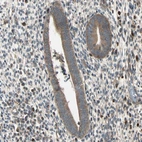 Immunohistochemical staining of human endometrium shows strong cytoplasmic positivity in glandular cells.