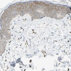 Immunohistochemical staining of human skin shows moderate cytoplasmic membranous positivity in squamous epithelial cells.