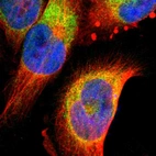 Immunofluorescent staining of human cell line U-251 MG shows localization to endoplasmic reticulum.