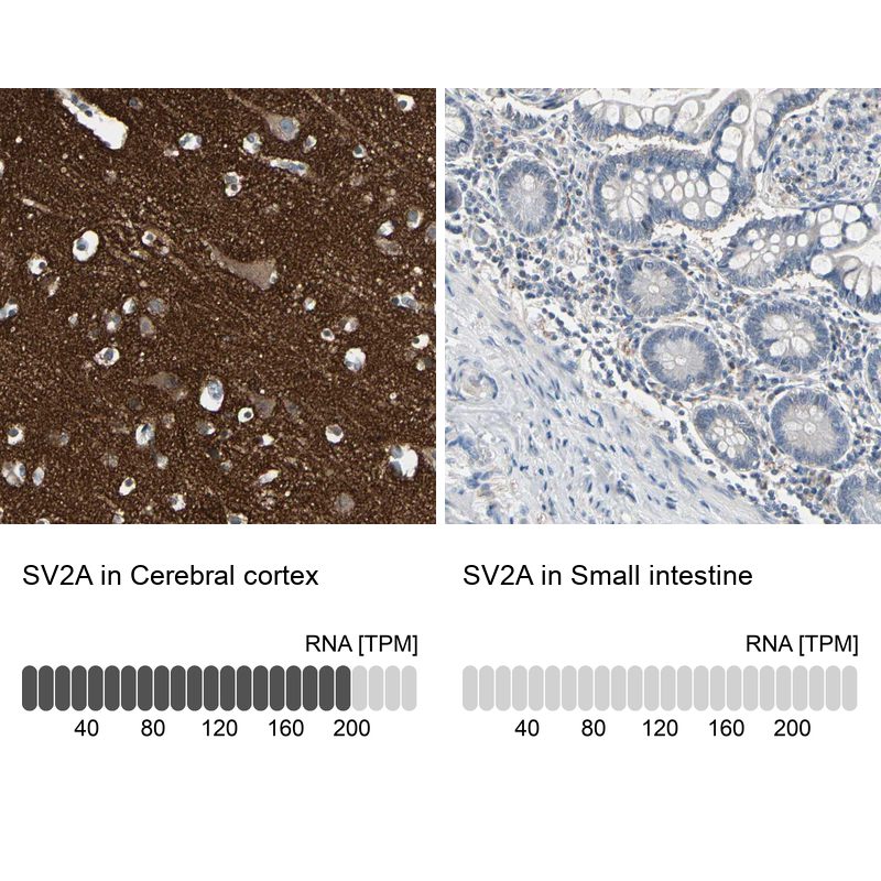 Anti-SV2A Antibody