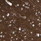 Immunohistochemical staining of human cerebral cortex shows strong cytoplasmic positivity in neuropil.