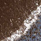 Immunohistochemical staining of human cerebellum shows strong cytoplasmic positivity in neuropil.