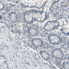 Immunohistochemical staining of human small intestine shows no positivity in glandular cells as expected.