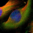 Immunofluorescent staining of human cell line U-251 MG shows localization to cytosol.