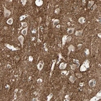 Immunohistochemical staining of human Cerebral cortex shows strong positivity in neuronal processes in neuropil.