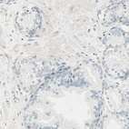 Anti-BCAN Antibody