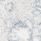 Immunohistochemical staining of human Prostate shows no positivity in glandular cells as expected.