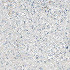 Anti-BCAN Antibody