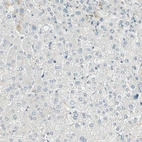 Immunohistochemical staining of human Liver shows no positivity in hepatocytes as expected.