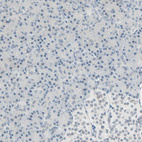 Anti-BCAN Antibody