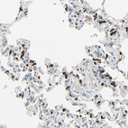 Immunohistochemical staining of human lung shows strong positivity in pneumocytes.