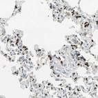 Immunohistochemical staining of human lung shows strong positivity in pneumocytes.