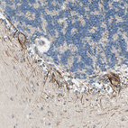 Immunohistochemical staining of human cerebellum shows positivity in Purkinje cells.