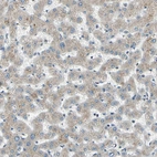 Immunohistochemical staining of human liver shows weak cytoplasmic positivity in hepatocytes.