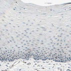 Immunohistochemical staining of human cervix shows no positivity in squamous epithelial cells as expected.