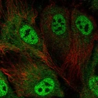 Immunofluorescent staining of human cell line HUVEC TERT2 shows localization to nucleoplasm & cytosol.