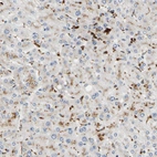 Immunohistochemical staining of human liver shows moderate to strong cytoplasmic positivity in Kupffer cells.