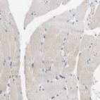 Immunohistochemical staining of human skeletal muscle shows no positivity in myocytes as expected.