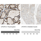 Anti-LPCAT2 Antibody