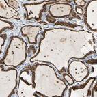 Immunohistochemical staining of human thyroid gland shows strong granular cytoplasmic positivity in glandular cells.