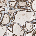 Immunohistochemical staining of human thyroid gland shows strong granular cytoplasmic positivity in glandular cells.