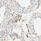 Immunohistochemical staining of human testis shows weak granular cytoplasmic positivity in Leydig cells.