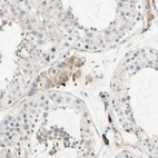 Immunohistochemical staining of human testis shows weak granular cytoplasmic positivity in Leydig cells.