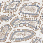 Anti-LPCAT2 Antibody