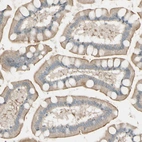 Immunohistochemical staining of human small intestine shows weak membranous positivity in glandular cells.