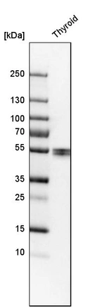 Western blot analysis in human thyroid gland tissue.