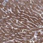 Immunohistochemical staining of human liver shows strong granular cytoplasmic positivity in hepatocytes.
