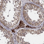 Immunohistochemical staining of human testis shows strong cytoplasmic positivity in Leydig cells.