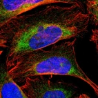 Immunofluorescent staining of human cell line U-2 OS shows localization to endoplasmic reticulum.
