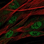 Immunofluorescent staining of human cell line ASC TERT1 shows localization to nucleoplasm.
