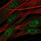 Immunofluorescent staining of human cell line ASC TERT1 shows localization to nucleoplasm.