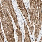 Anti-P4HA3 Antibody