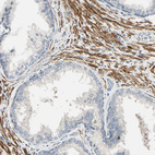 Anti-P4HA3 Antibody