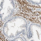 Immunohistochemical staining of human prostate shows strong cytoplasmic positivity in smooth muscle cells.