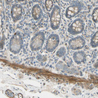 Anti-P4HA3 Antibody