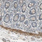 Immunohistochemical staining of human small intestine shows moderate cytoplasmic positivity in smooth muscle cells.