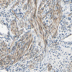 Immunohistochemical staining of human uterus shows moderate cytoplasmic positivity in smooth muscle cells.