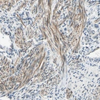 Immunohistochemical staining of human uterus shows moderate cytoplasmic positivity in smooth muscle cells.