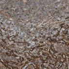 Immunohistochemical staining of human spleen shows strong membranous positivity in cells in red pulp.